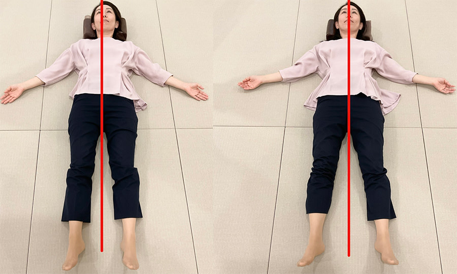 仰向けに寝た女性を2枚並べた比較写真。体の中心に縦の赤線が引かれ、左は体が赤線に対して傾いてずれており、右は体が赤線に沿ってまっすぐになっている